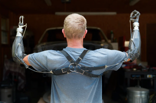 Before the Bionics: 5 Reasons Amputees Start with Body-Power