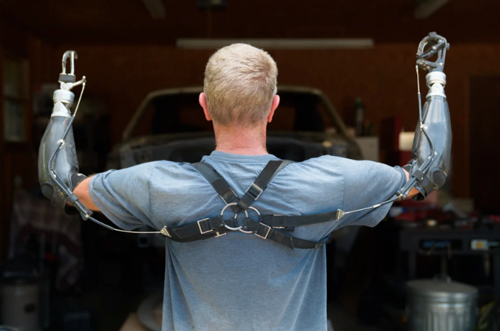 Body Powered Device Before the Bionics: 5 Reasons Amputees Start with Body-Power – Marins Inc.