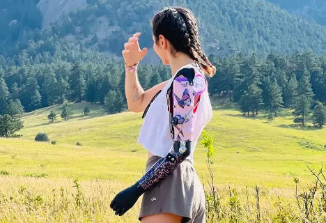 Prosthetic Inclusivity: The Need for Personalization