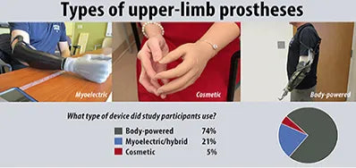 Choosing an Upper-Limb Prosthetic
