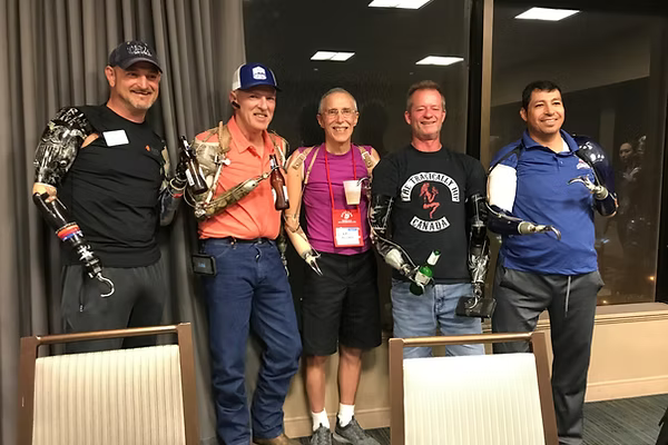 Five men amputees posing together indoors, wearing upper limb prosthetic devices.